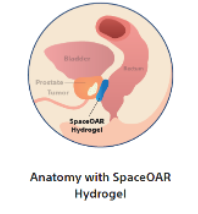 Anatomy-with-SpaceOAR