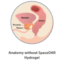Anatomy-without-SpaceOAR