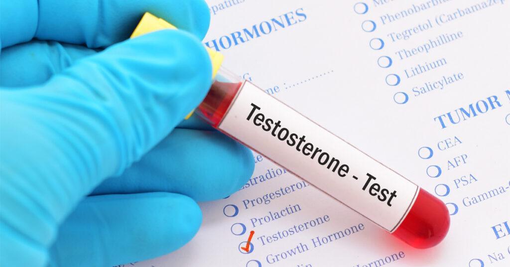 testosterone test