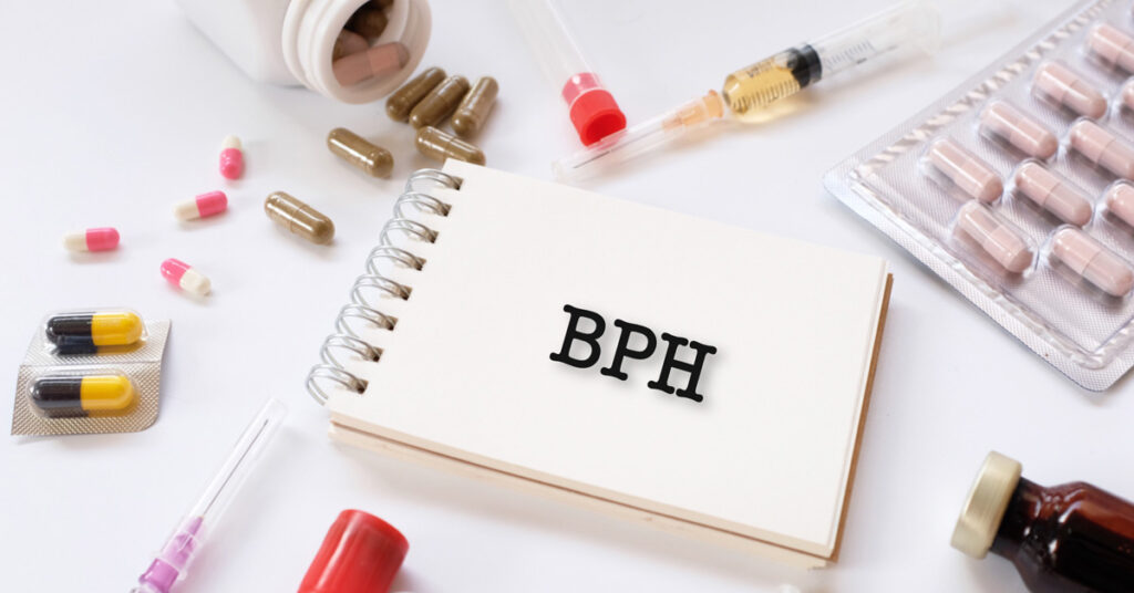 BPH Treatment Options